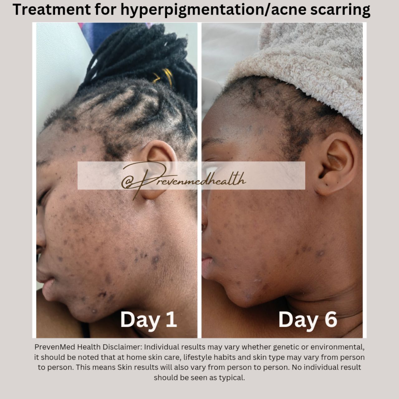 Algae Peel