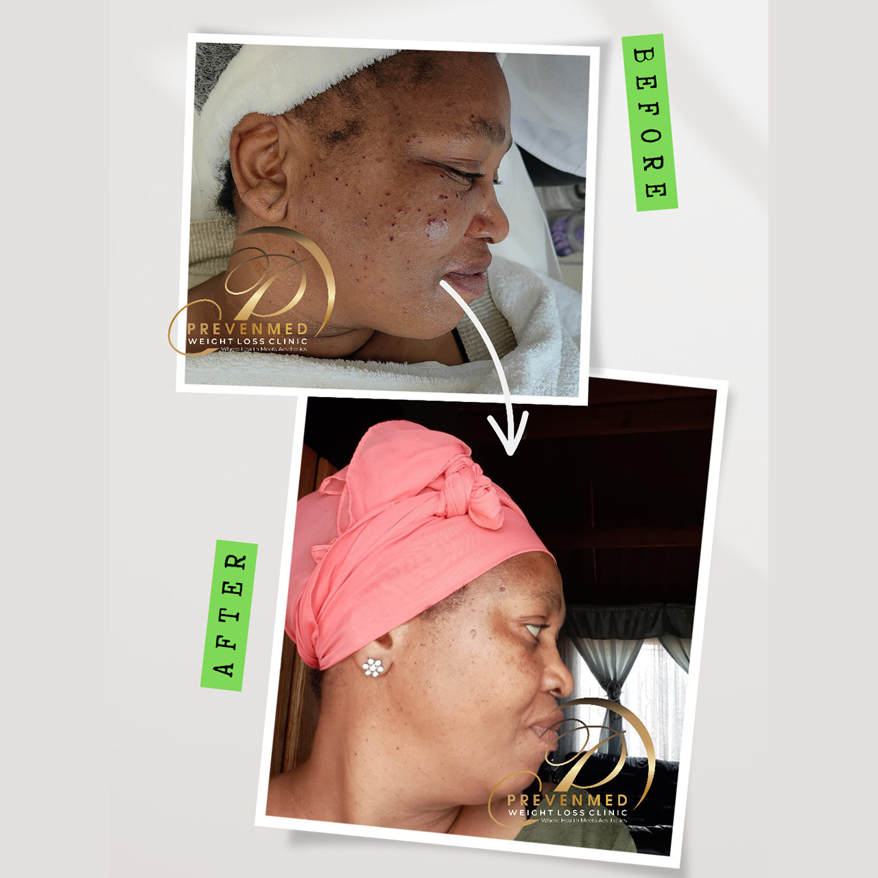 beforeafter1